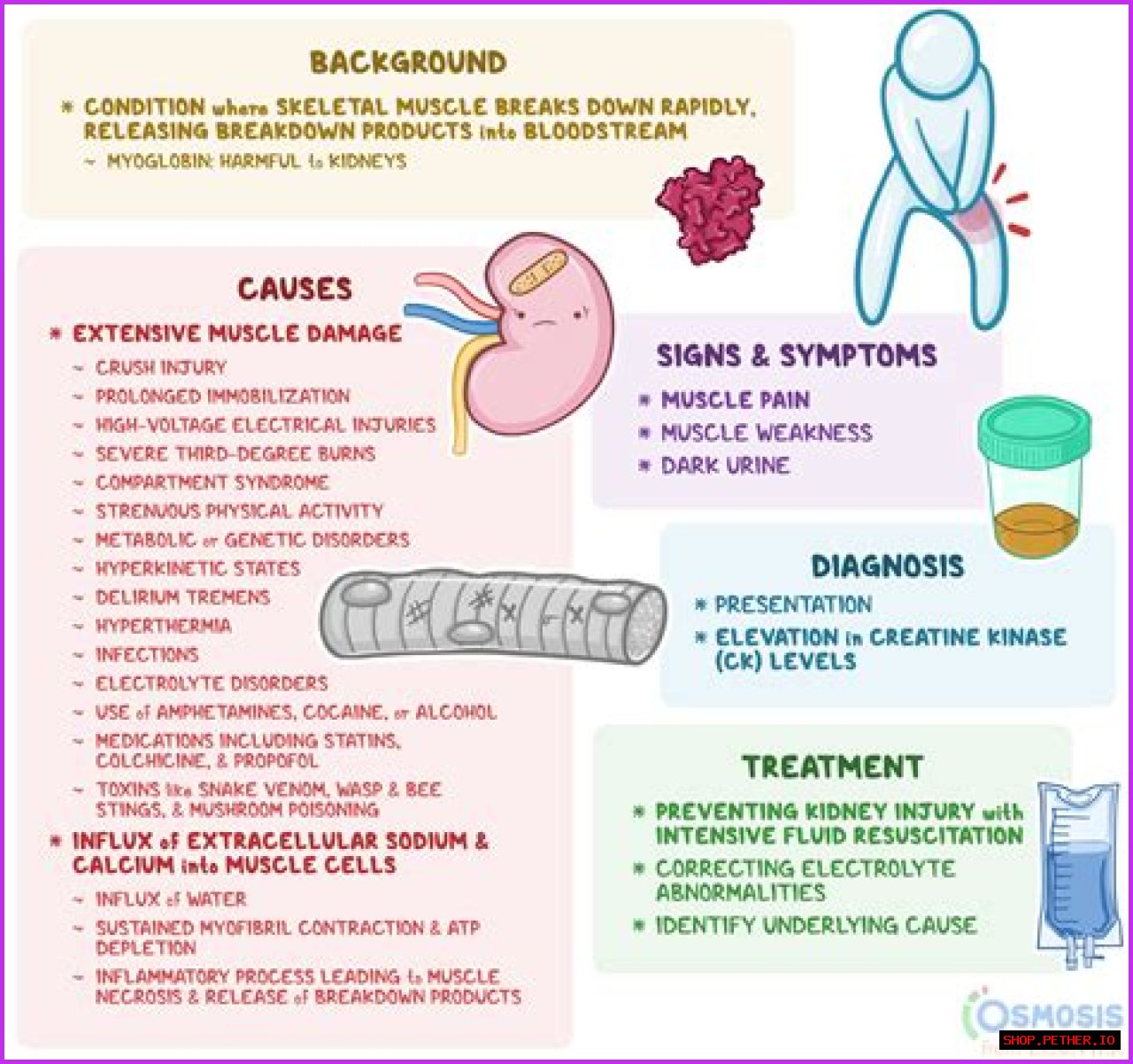Understanding Hasbulla Disease: Causes, Symptoms, And Treatment